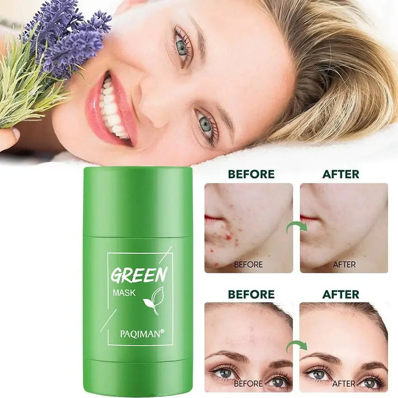 Green mask - Máscara facial removedora de cravos